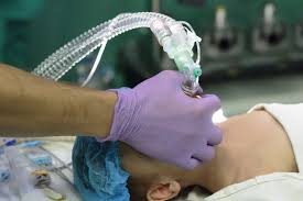 anesthesia errors