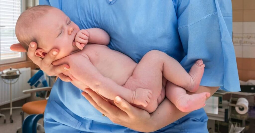 Delaware Erb's Palsy Lawyers | Erb's Palsy Lawsuits | Birth Injury Lawyer